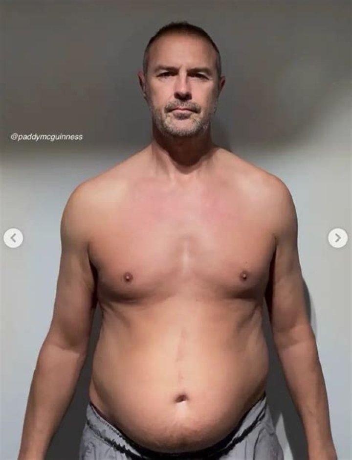 Paddy Mcgurgan Weight Loss 