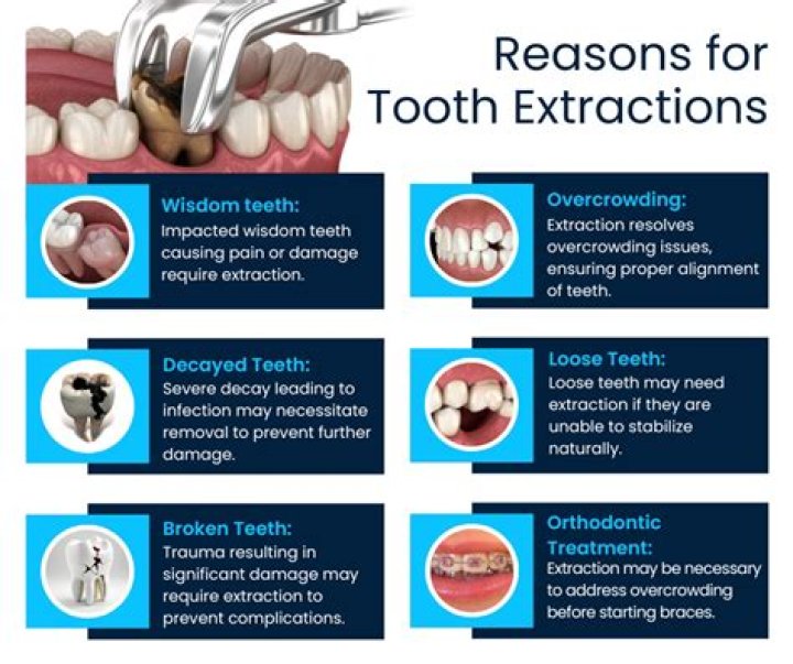 risks of tooth extraction