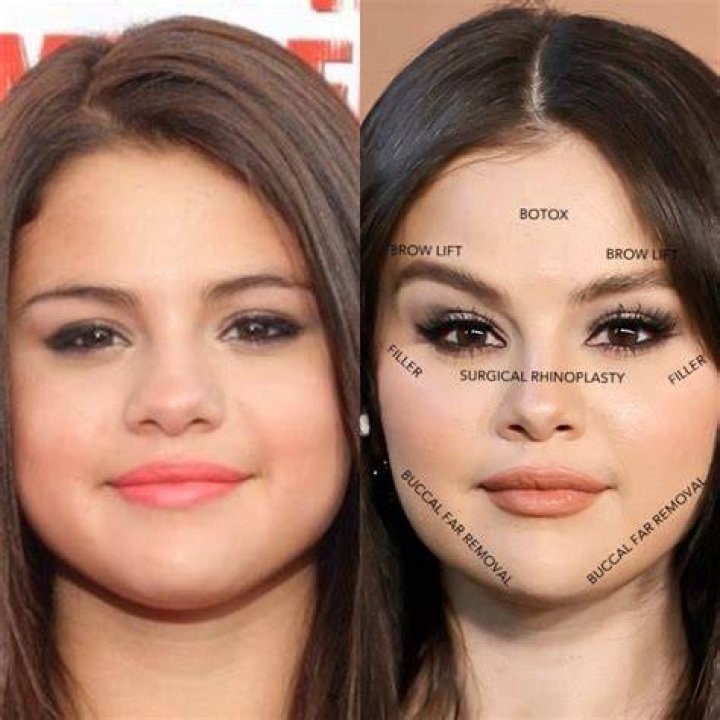 Selena Gomez Before and After
