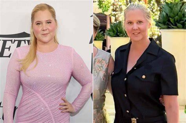 US Actress Amy Schumer has shared her journey with endometriosis. US Actress Amy Schumer has shared her journey with endometriosis.